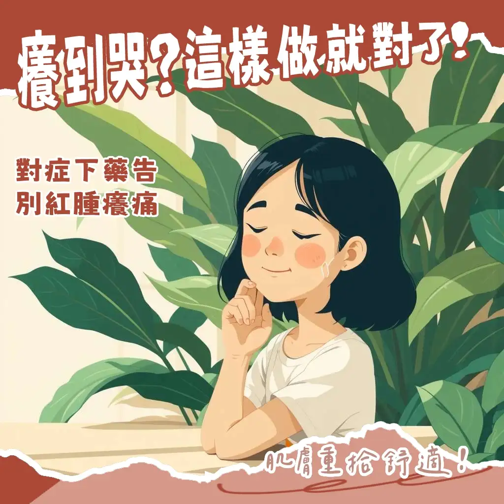 小黑蚊叮咬後紅腫肌膚，正在塗抹止癢藥膏，特寫藥膏成分與處理步驟，幫助快速止癢消腫。